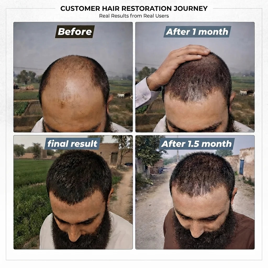 Best Hair Oil in Pakistan – Desi Khazanay Regrowth Hair Oil